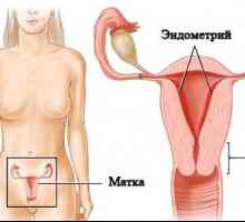 Endometrioza uter: Simptome
