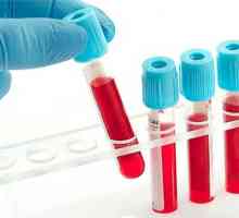 Care este rata de hemoglobină din sânge femeilor?