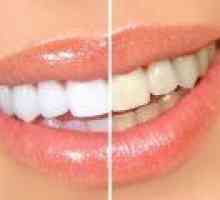 Este posibil să albiți dinții acasă? Cele mai populare metode