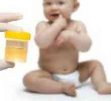 Norme de urină la adulți, la copii