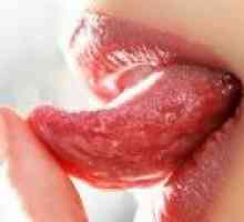 Inflamație a limbii, cauzele și tratamentul