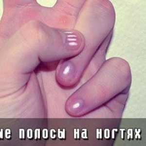 Dungi albe pe unghiile de la maini
