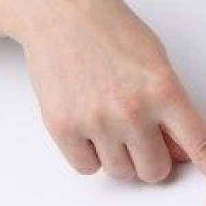 De multe ori doare degetul arătător, ce să fac?