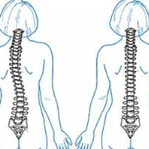 Ce se va chiropractician pentru dureri de spate?