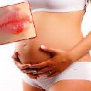 Herpes in timpul sarcinii - fie că este periculos?