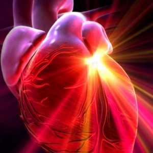 Defecte cardiace: clasificare