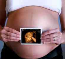 3D cu ultrasunete în timpul sarcinii