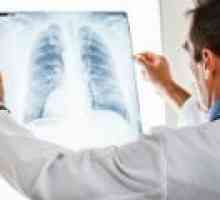 Lung abces: cauze, simptome, tratament