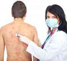 Alergic la nivelul pielii, erupții cutanate alergice
