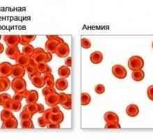 Anemia de sânge, ceea ce duce la anemie, sânge?