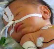 Artreziya esofagului la nou-nascuti