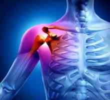 Artrita articulatiei umarului: Simptome si tratament