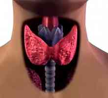 Tiroidă tiroidita autoimuna