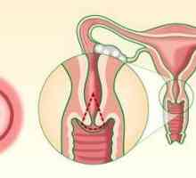 Biopsie de col uterin: ce este