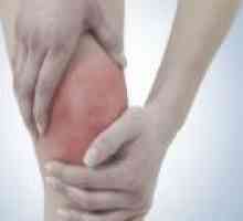 Boala Hoff a genunchiului: cauze, tratament