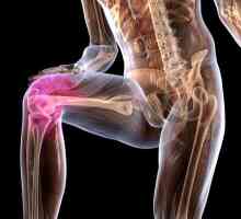 Boala articulației genunchiului Koenig