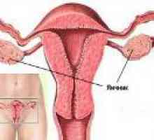 Ovarelor Sore si abdomen - ce să fac?