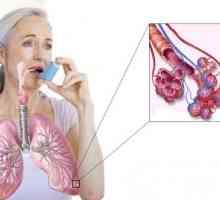 Astmul: Simptome si tratament