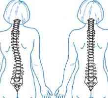 Ce se va chiropractician pentru dureri de spate?
