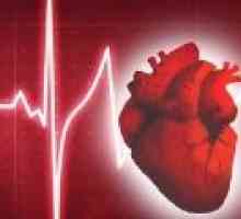Ce este un ritm cardiac anormal?