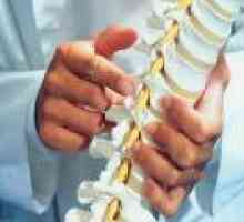 Deformant de col uterin spondiloza, toracice și a coloanei vertebrale lombare
