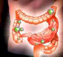 Intestinale disbioză: simptome și tratament la adulți