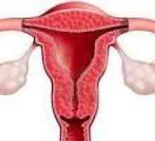 Hiperplazie endometrială după chiuretaj