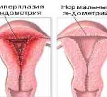 Tratamentul menopauzei hiperplazie endometrială