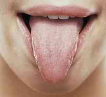 Glosita - o inflamație a limbii