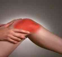 Osteoartrita a genunchiului: cauze, tratament