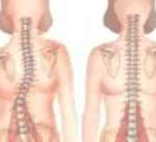 Herniate SHmorlja spinale: simptome, tratament