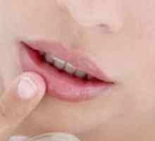 Buzele sparge în mod constant și colțuri ale gurii apar „veți alege“