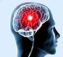 Simptomele accident vascular cerebral sunt primele semne ale