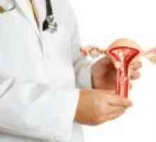 Fibrom uterin interstițiale - cauze, simptome, tratament