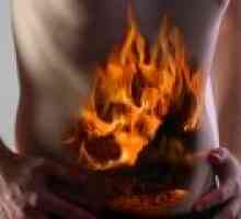 Arsuri la stomac - cauze, tratament, tratament pentru arsuri la stomac