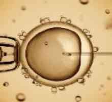 Fertilizarea in vitro (FIV) - cum să se pregătească?