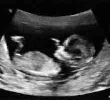 Cum de a descifra ultrasunete in timpul sarcinii?