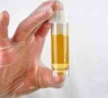 Cum să treacă un test de urină în timpul sarcinii?
