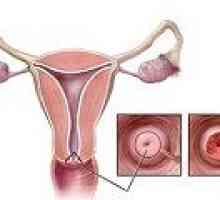 De col uterin biopsie con: indicații, comentarii