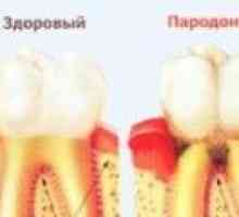 Tratamentul bolii parodontale la domiciliu