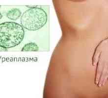 Tratamentul cu Ureaplasma la femei, la bărbați
