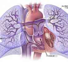 Inima pulmonară