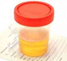 Leucocitele din cauze urină a crescut