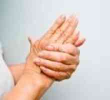 Dureri articulare ale mâinilor și picioarelor: cauze, tratament