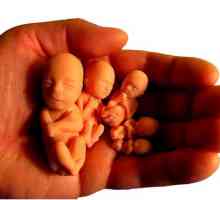 Avortul Medical: Implicații