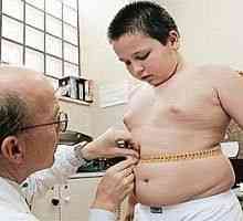 Metformina este ineficient în tratamentul obezității copilarie