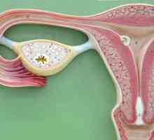 Fibrom uterin dimensiune pentru operații