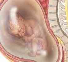 Polihidramnios în timpul sarcinii, cauze, consecințe