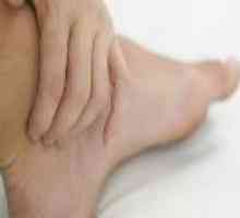Picior piciorul stâng amortit, cauze, tratament