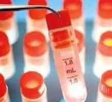 Urmatoarele experimente cu celule stem